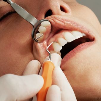 Fear of Dental Procedures